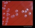 neisseria gonorrhoeae